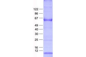 Validation with Western Blot (MAGEC2 Protein (His tag))