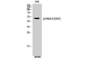 Western Blotting (WB) image for anti-Programmed Cell Death 4 (PDCD4) (pSer457) antibody (ABIN3182643) (PDCD4 antibody  (pSer457))