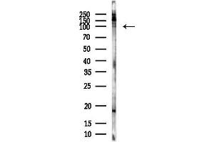 anti-MLX Interacting Protein-Like (MLXIPL) antibody