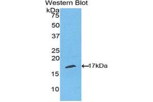 Western Blotting (WB) image for anti-RELT Tumor Necrosis Factor Receptor (RELT) (AA 222-363) antibody (ABIN1860801) (RELT antibody  (AA 222-363))