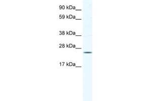 Western Blotting (WB) image for anti-Potassium Channel Tetramerisation Domain Containing 6 (KCTD6) antibody (ABIN2461578) (KCTD6 antibody)