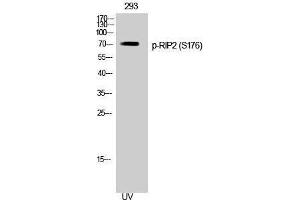 Western Blotting (WB) image for anti-ROP Interactive Partner 2 (RIP2) (pSer176) antibody (ABIN3182676) (RIP2 antibody  (pSer176))