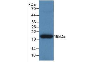 Detection of Recombinant TNC, Human using Polyclonal Antibody to Tenascin C (TNC) (TNC antibody  (AA 49-181))