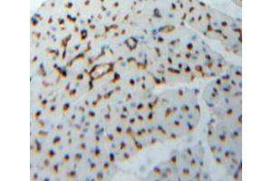 Used in DAB staining on fromalin fixed paraffin-embedded heart tissue (TNNI2 antibody  (AA 1-182))