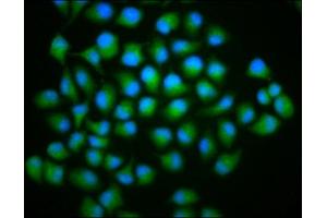Immunofluorescence staining of Hela cells with ABIN7173520 at 1:166, counter-stained with DAPI.