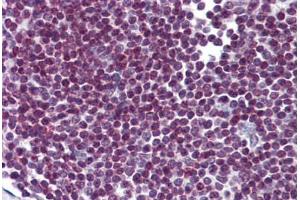 Human Spleen: Formalin-Fixed, Paraffin-Embedded (FFPE) (FOXO3 antibody  (AA 361-460))