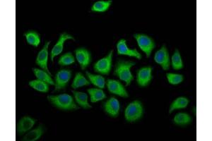 Immunofluorescence staining of A549 cells with ABIN7144528 at 1:166, counter-stained with DAPI. (ALOX12 antibody  (AA 508-658))