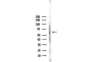 Western blot analysis of lysates from Mouse lung, using Phospho-SQSTM1/p62 (Ser403) Antibody at 1/1000 dilution.