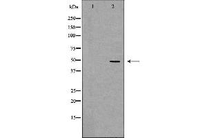 Western blot analysis of Jurkat whole cell lysates, using ACTR3 Antibody.