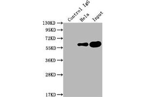 Immunoprecipitating PKM in Hela whole cell lysate Lane 1: Rabbit control IgG instead of ABIN7127769 in Hela whole cell lysate. (Recombinant PKM antibody)