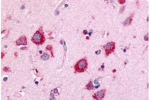 Anti-NEK7 antibody  ABIN1049091 IHC staining of human brain, neurons and glia. (NEK7 antibody  (Kinase Domain))