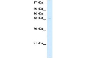 Human HepG2; WB Suggested Anti-ZNF70 Antibody Titration: 5.