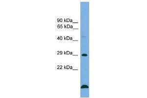 WB Suggested Anti-BCL2 Antibody Titration: 0. (Bcl-2 antibody  (Middle Region))