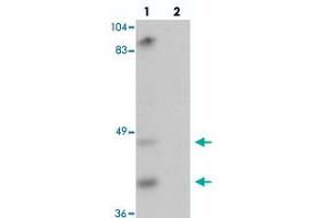 Western blot analysis of TMPRSS11A in mouse liver tissue with TMPRSS11A polyclonal antibody  at 1 ug/mL in (lane 1) the absence and (lane 2) the presence of blocking peptide. (TMPRSS11A antibody  (C-Term))