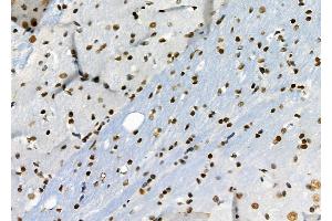 ABIN6264661 and ABIN6276692 at 1/100 staining Rat brain tissue by IHC-P.