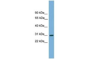 WB Suggested Anti-HLA-DQA2 Antibody Titration:  0. (HLA-DQA2 antibody  (Middle Region))