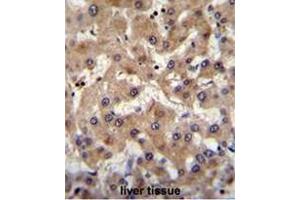 PRAMEF6 Antibody (C-term) immunohistochemistry analysis in formalin fixed and paraffin embedded human liver tissue followed by peroxidase conjugation of the secondary antibody and DAB staining. (PRAMEF6 antibody  (C-Term))