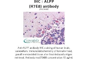 Image no. 1 for anti-Placental Alkaline Phosphatase (ALPP) antibody (ABIN1723355) (PLAP antibody)
