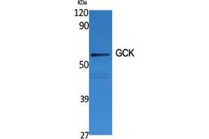 Western Blot (WB) analysis of specific cells using GCK Polyclonal Antibody. (GCK antibody  (N-Term))