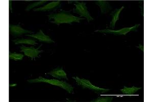 Immunofluorescence of monoclonal antibody to CYP1A2 on HeLa cell. (CYP1A2 antibody  (AA 211-310))