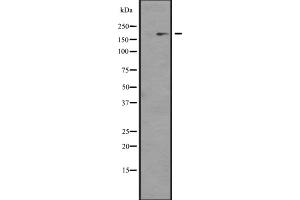 Western blot analysis of NCOA1 expression in KAT13A / SRC1 transfected 293 cell line lysate;,The lane on the left is treated with the antigen-specific peptide. (NCOA1 antibody)