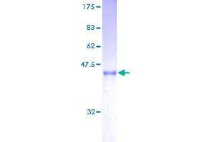 ARL2BP Protein (AA 1-163) (GST tag)