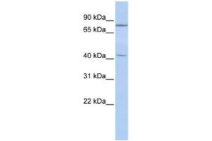 WB Suggested Anti-KLHL3 Antibody Titration:  0. (KLHL3 antibody  (Middle Region))