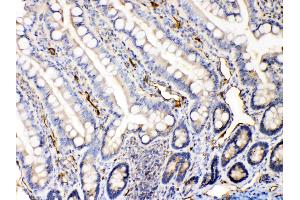 IHC analysis of Bax using anti-Bax antibody . (BAX antibody  (N-Term))