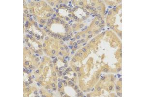 Immunohistochemistry of paraffin-embedded human kidney using SMYD5 antibody (ABIN6129324, ABIN6148173, ABIN6148174 and ABIN6221783). (SMYD5 antibody)