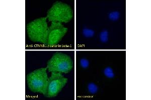 ABIN2630016 Immunofluorescence analysis of paraformaldehyde fixed U2OS cells, permeabilized with 0. (CTNNB1 antibody  (AA 108-121))