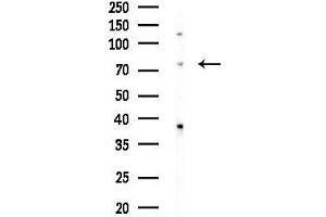 Western blot analysis of lysates from HUVEC cells, using HSPB Antibody at 1/1000 dilution.