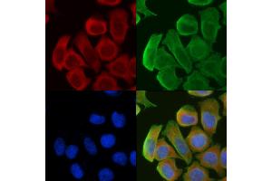 ABIN6261640 and ABIN6276821 staining Hela cells(30 min of UV treatment) by IF/ICC. (F12 antibody  (C-Term))