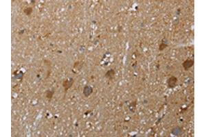 The image on the left is immunohistochemistry of paraffin-embedded Human brain tissue using ABIN7129016(COX6B2 Antibody) at dilution 1/50, on the right is treated with fusion protein. (COX6B2 antibody)