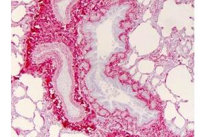 Immunohistochemistry (IHC) image for anti-COL1A2/COL1A1 antibody (ABIN5596819)