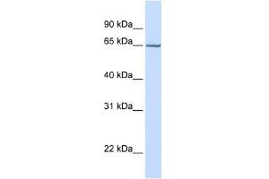 GALNAC4S-6ST antibody used at 1 ug/ml to detect target protein. (CHST15 antibody  (Middle Region))