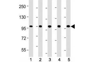 Western blot testing of LGR-5 antibody at 1:2000 dilution. (LGR5 antibody  (AA 689-719))