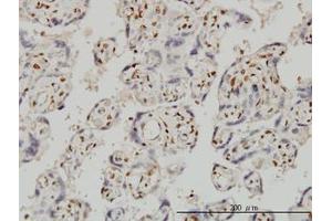 Image no. 1 for anti-Forkhead Box R2 (FOXR2) (AA 1-312) antibody (ABIN599326) (FOXR2 antibody  (AA 1-312))