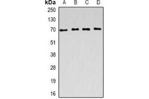 Western blot analysis of ACADVL expression in SW620 (A), Raji (B), mouse kidney (C), rat liver (D) whole cell lysates. (ACADVL antibody)