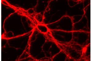 Immunocytochemistry (ICC) image for anti-tau Protein (AA 3-214) antibody (ABIN1742569) (tau antibody  (AA 3-214))