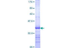 TCIRG1 Protein (AA 121-220) (GST tag)