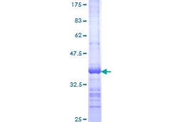 TCIRG1 Protein (AA 121-220) (GST tag)