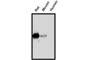 Western Blotting (WB) image for anti-Interleukin 18 (IL18) (AA 37-194) antibody (ABIN1449292) (IL-18 antibody  (AA 37-194))