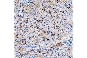 IHC analysis of SNRNP200 using anti-SNRNP200 antibody (ABIN7602032). (SNRNP200 antibody  (AA 557-2129))