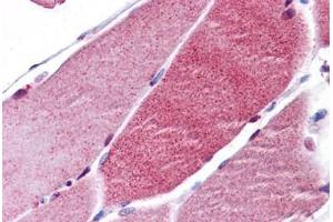 Immunohistochemistry (Formalin-fixed Paraffin-embedded Sections) (IHC (fp)) image for anti-Forkhead Box O3 (FOXO3) (N-Term) antibody (ABIN625926)