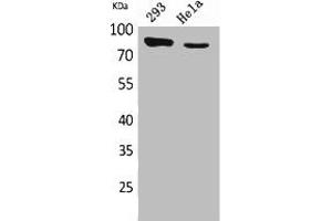 Western Blot analysis of 293, HeLa cells using DRA Polyclonal Antibody. (SLC26A3 antibody  (C-Term))