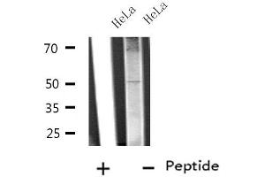 Western blot analysis of extracts from HeLa cells, using SLC38A2 antibody. (SLC38A2 antibody  (Internal Region))