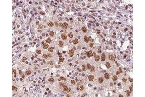 ABIN6266816 at 1/100 staining human liver tissue sections by IHC-P. (XRN2 antibody)