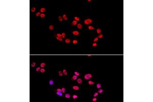 Immunofluorescence analysis of HeLa cells using XRCC5 antibody. (XRCC5 antibody  (AA 543-732))