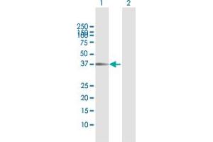 TNK2 antibody  (AA 1-352)