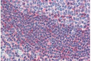 Human Tonsil (formalin-fixed, paraffin-embedded) stained with GSC antibody ABIN462175 followed by biotinylated goat anti-rabbit IgG secondary antibody ABIN481713, alkaline phosphatase-streptavidin and chromogen. (GSC antibody  (AA 35-84))